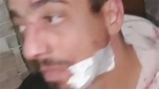 بسبب فرشة بيع.. اعتداء بسكاكين على بائع أحذية في جسر السويس