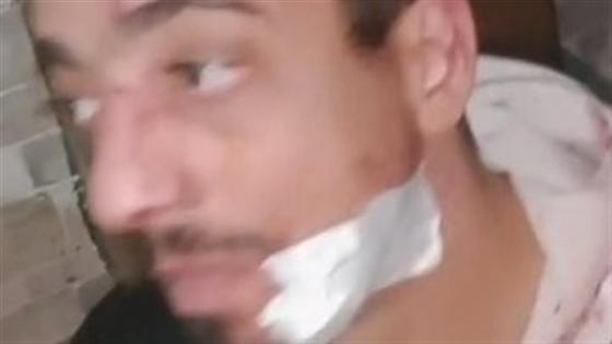 بسبب فرشة بيع.. اعتداء بسكاكين على بائع أحذية في جسر السويس