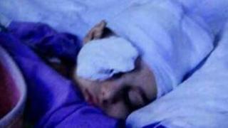 تلميذ فقأ عين زميله بمدرسة مصطفي كامل بالقليوبية