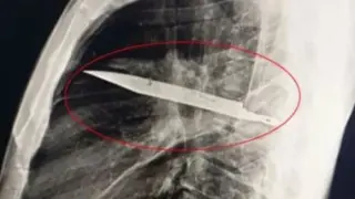 أمن الجيزة يلقي القبض على سيدة طعنت زوجها خلال مشاجرة بـ 6 أكتوبر