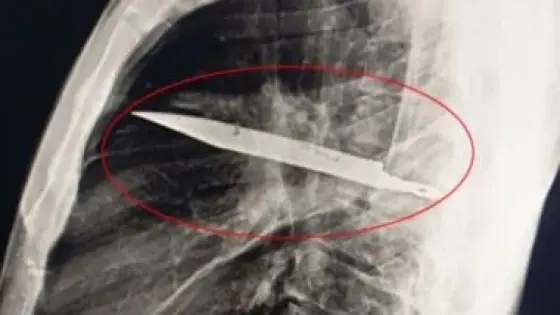 أمن الجيزة يلقي القبض على سيدة طعنت زوجها خلال مشاجرة بـ 6 أكتوبر