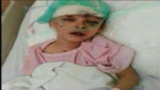 مصرع طفله صدمتها سياره ببنى سويف