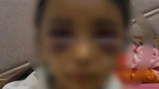 غيرة تحولت إلى انتقام.. زوجة أب تشوه براءة طفلتين في الشرقية أثناء سفر والدهما