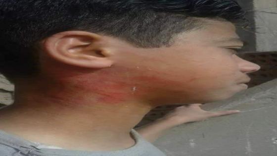 اعتداء مدرس علي طالب اثناء الطبور بالباجور بمحافظة المنوفية