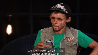 قصة “الطفل القمري”.. أحمد مبيقدرش يشوف الشمس