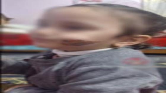 الأجهزة الأمنية بكفر الشيخ تضبط أماً عذبت طفلتها وأحرقت وجهها