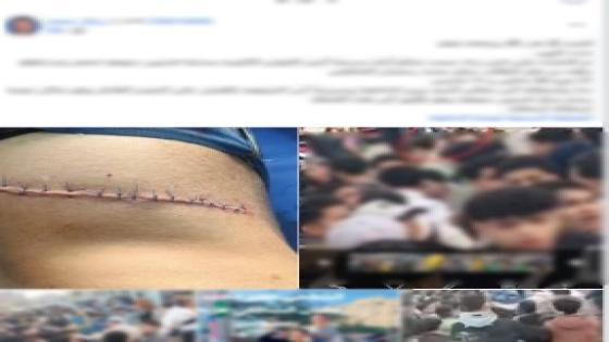 سقوط “طالبي السلاح الأبيض” بالمنوفية بعد إصابة زميلهما