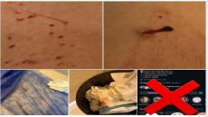 تشوهات وحروق وإهمال طبي.. شكوى صارخة ضد مركز “ديرما كلوب” للتجميل تفجر غضب السوشيال ميديا