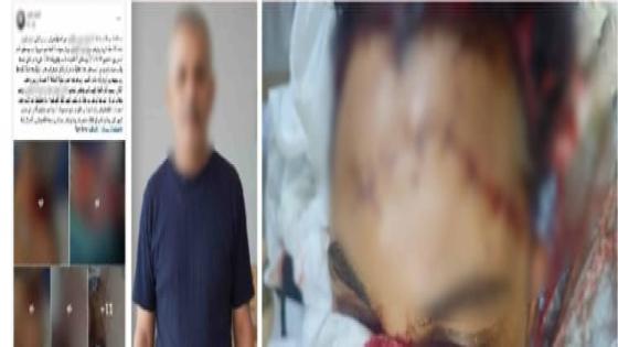 كشف ملابسات منشور متداول بالمنوفية.. مشاجرة بين باعة بسوق الخضار واتهامات كاذبة ضد الشرطة