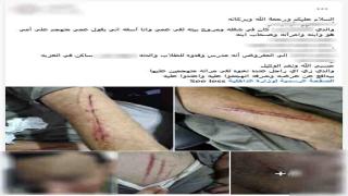 الأمن يكشف ملابسات الاعتداء على عامل بسبب خلافات الميراث في الشرقية