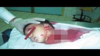 مزراع يذبج طفلة بقنا لوجود خلافات مالية مع والدها