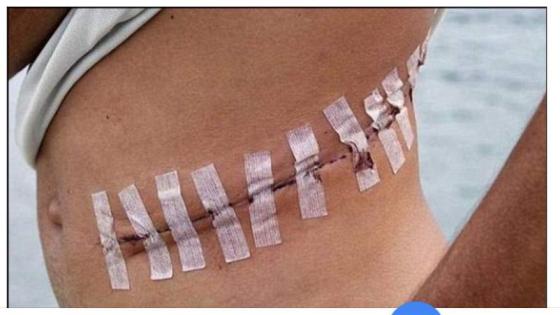 سماسرة بيع «الكلى» .. كهربائي يبيع “كليته” مقابل 14 ألف جنيه بالمنوفية