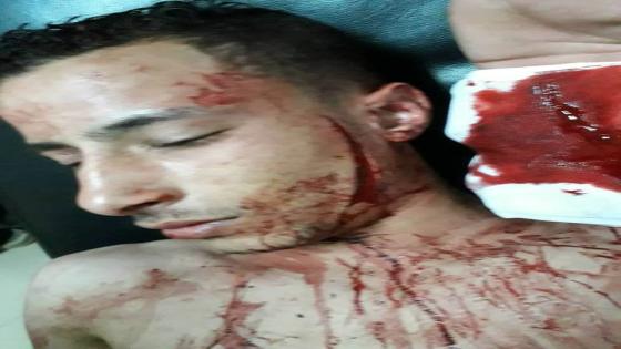 بالصور…زناتي وحاتم يجتمعون في شخص أمين شرطة قسم باب شرق بعد فتح وجه طالب الهندسه ابن كفر الدوار