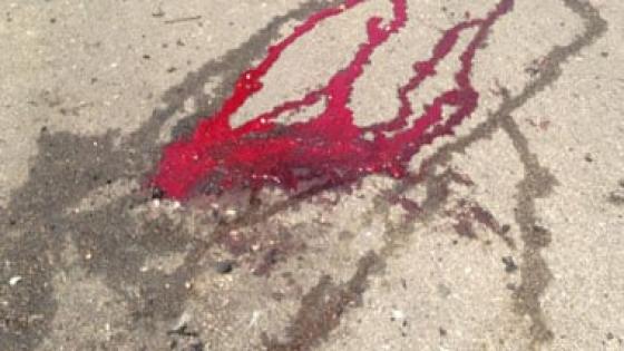 دماء ملائكة الرحمة على أسفلت كفر الشيخ .. ميكروباص التمريض أصاب 6 طالبات