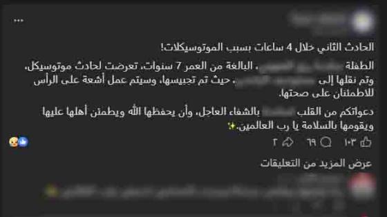 ضبط طالب صدم طفلة بدراجته النارية وأصابها بكسر في القدم بالغربية